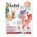 Dangers of Alcohol Anatomical Chart 2nd Edition