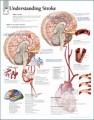 Understanding Stroke Anatomy Poster
