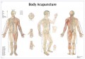 Acupuncture Poster