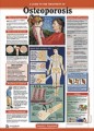 Osteoporosis Patient Anatomical Chart