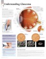 Eye Glaucoma Poster