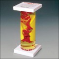 Occluded Artery Anatomical Model