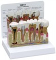 Teeth Dental Model