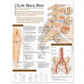 Low Back Pain Chart