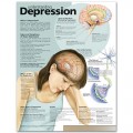 Understanding Depression Anatomical Chart 2nd Edition