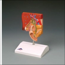 Gallbladder Gallstone Anatomical Model