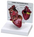Canine Heartworm Disease Model