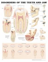 Teeth and Jaw Disorders Anatomical Dental Chart