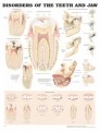 Teeth and Jaw Disorders Anatomical Dental Chart