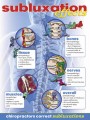 Subluxation Effects Poster