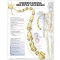 Understanding Multiple Sclerosis Anatomical Chart