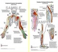 Peripheral Entrapment Neuropathies Anatomical Poster