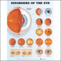 Disorders of the Eye 2nd Edition Anatomical Chart