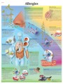 Allergies Chart