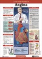 Angina Patient Anatomical Chart