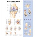 Knee Injuries Anatomical Chart