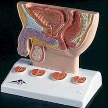 Prostate Model