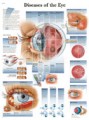 Eye Diseases Anatomy Poster