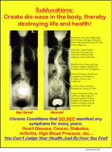Subluxation Poster