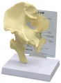Hip Anatomical Model Basic