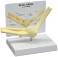 Elbow Anatomical Model