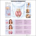 Thyroid Disorders Anatomical Chart