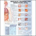 Sexually Transmitted Infections (STIs) Anatomical Chart