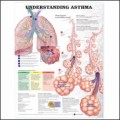 Asthma Anatomical Chart 2nd Edition