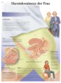 Incontinence urinaire chez la femme Chart
