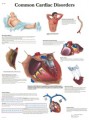 Common Cardiac Disorders Anatomical Poster