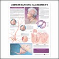 Understanding Alzheimer's Anatomical Chart