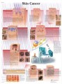 Skin Cancer Anatomical Poster