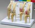Canine Knee Model - 4 stages of Osteoarthritis