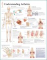 Arthritis  Poster