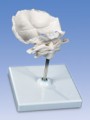 Atlas and Axis Vertebrae, with occipital plate, assembled, on removable stand