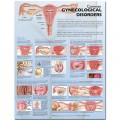 Common Gynecological Disorders Anatomical Chart