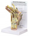 Hanf Rheumatoid Arthritis Anatomical Model
