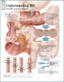 Understanding IBS (irritable bowel syndrome) Anatomical Poster