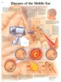 Ear Anatomical Poster Diseases of the Middle