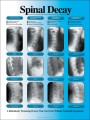 Spinal Decay Chiropractic poster