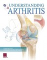 Arthritis Educational Flip Chart