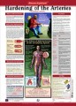 Hardening of the Arteries Anatomy Poster