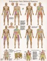 Sclerotome / Visceral Pain Referral Poster