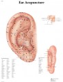 Ear Acupuncture Poster