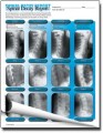 Spinal Decay Report Insert