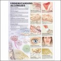 Allergies Anatomical Chart 2nd Edition