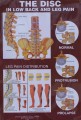 Disc and Vertebrae Anatomical Poster