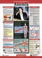 Anemia Patient Anatomical Chart