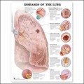 Diseases of the Lung Anatomical Chart