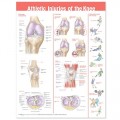 Athletic Injuries of the Knee Poster